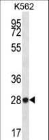 Polyclonal Rabbit anti-Human ZNF146 Antibody (aa17-45, WB)