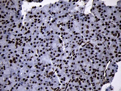 SMC1A / SMC1 Antibody (aa889-1016, clone OTI11E1)