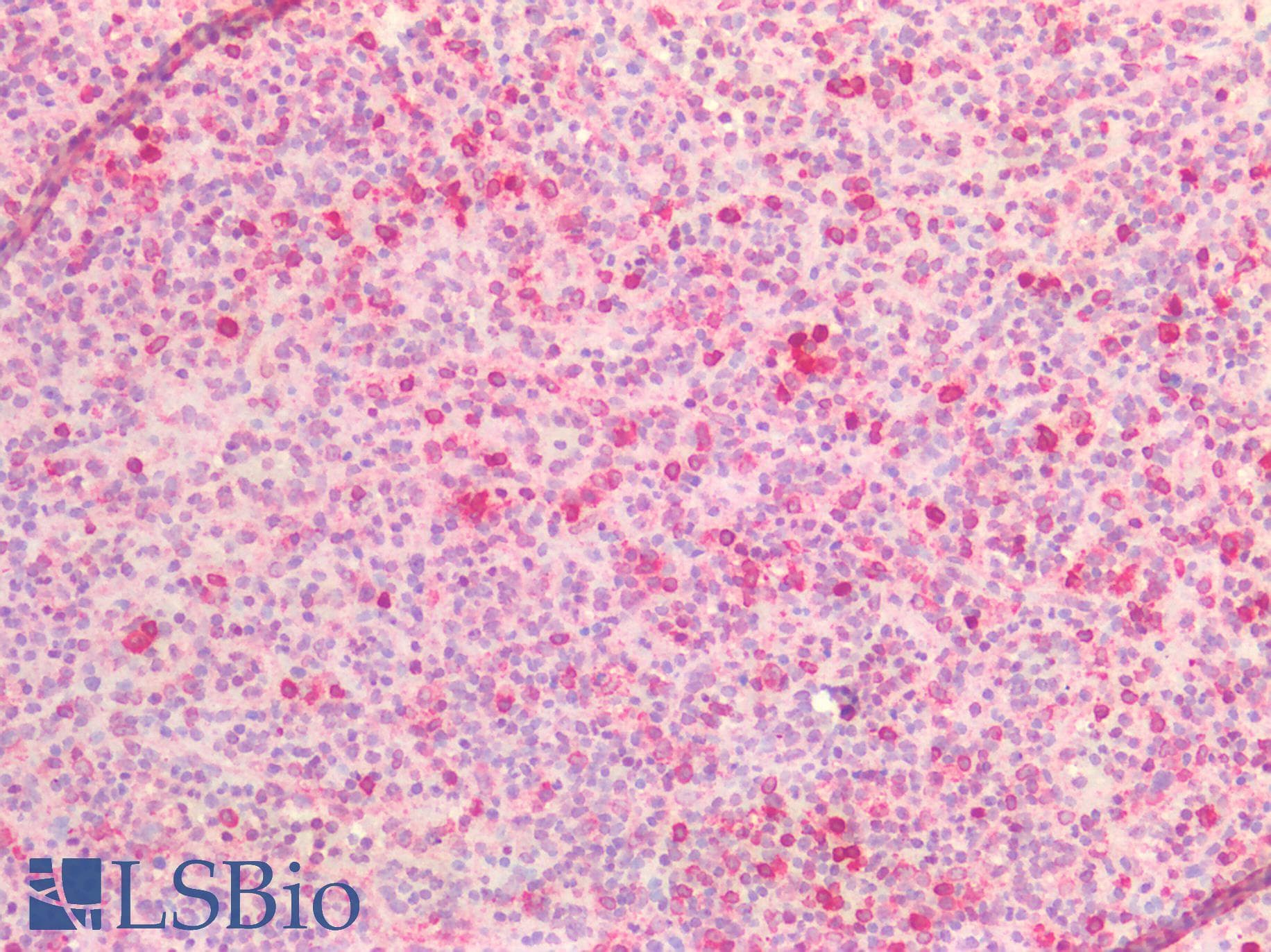 IHC-plus™ CD74 / CLIP Antibody (aa1-58)