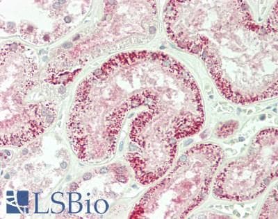 IHC-plus™ PKP4 / Plakophilin 4 Antibody (aa1040-1068)