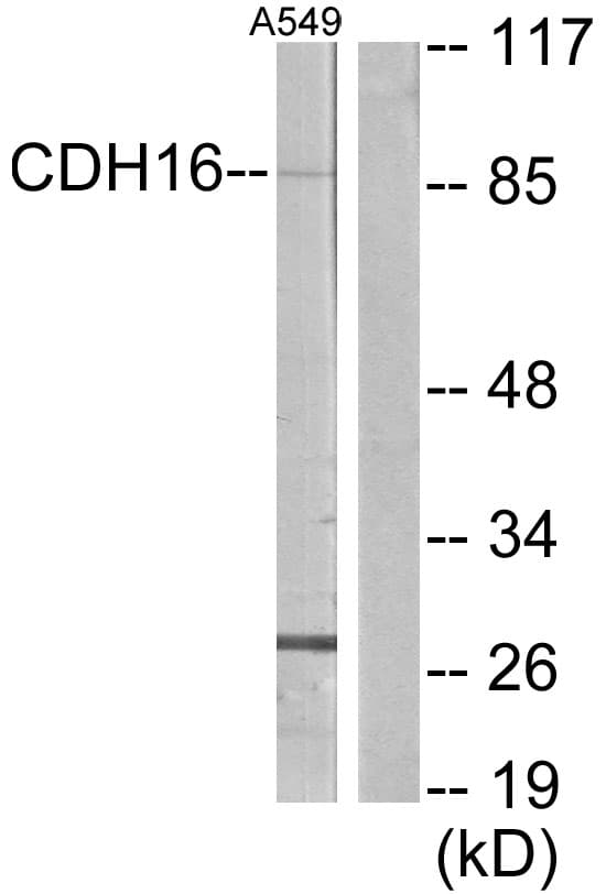 Polyclonal Rabbit anti-Human CDH16 / Cadherin 16 Antibody (aa780-829, WB)