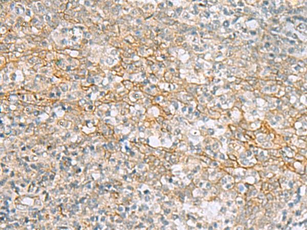 KCNH7 / ERG3 Antibody