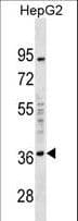 Polyclonal Rabbit anti-Human EDA2R / XEDAR Antibody (aa267-297, WB)