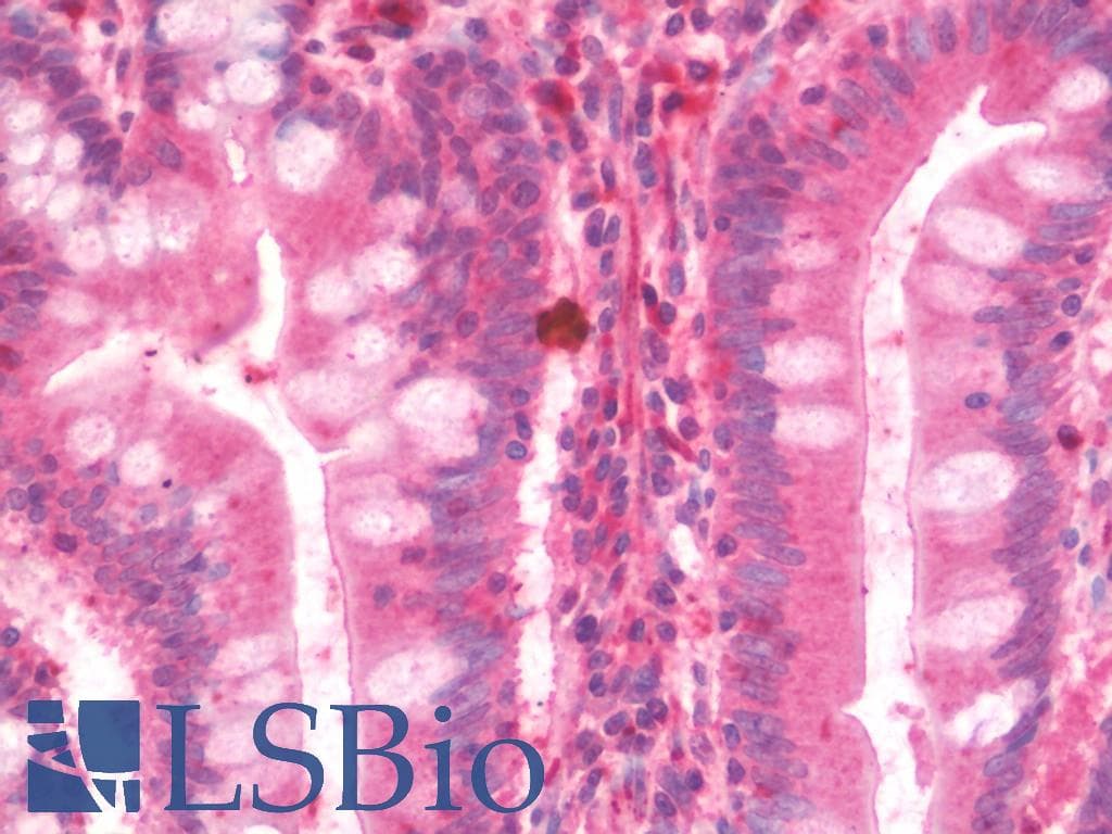 IHC-plus™ Scavenger Receptor BI + BII Antibody (aa230-380)