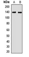 MTMR3 Antibody