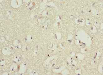 PPP2R1B Antibody