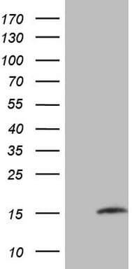 Monoclonal Mouse anti-Human MGP / Matrix Gla-Protein Antibody (clone OTI11G6, WB)