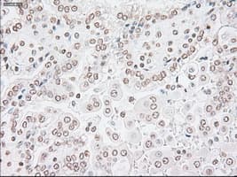 GFAP Antibody (clone OTI4D11)