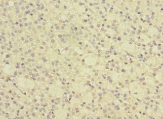 Polyclonal Rabbit anti-Human GRPEL2 Antibody (IHC)