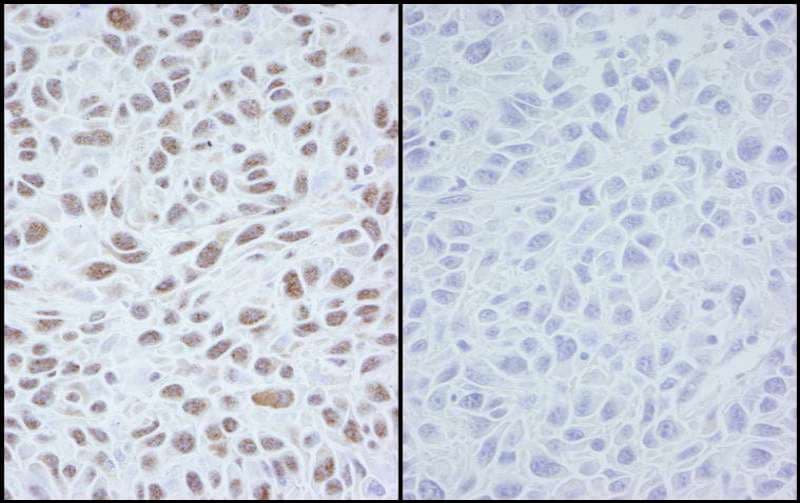 SMC1A / SMC1 Antibody (phospho-Ser966)