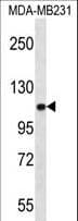 IHC-plus™ ACTN3 Antibody (aa409-437)