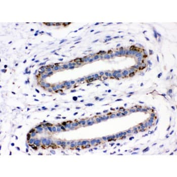 Junctin / ASPH Antibody (aa726-758)