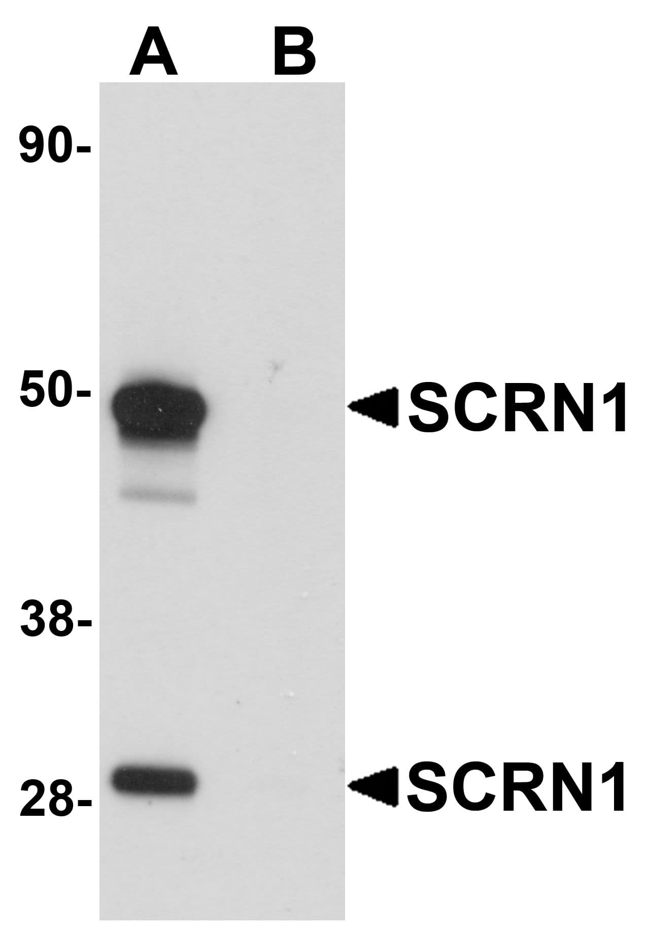 IHC-plus™ SCRN1 / Secernin 1 Antibody