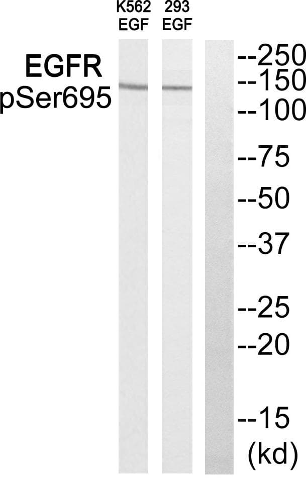 Polyclonal Rabbit anti-Human EGFR Antibody (phospho-Ser695, WB)