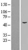 PCYOX1 Protein (Over-Expression Lysate Myc-DDK (Flag))