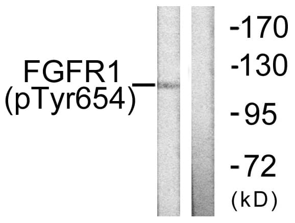 FGFR1 / FGF Receptor 1 Antibody (phospho-Tyr654)