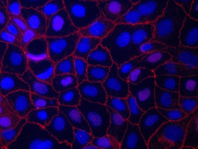 Monoclonal Mouse anti-Human TJP1 / ZO-1 Antibody (clone ZO1-1A12, AF594, aa334-634, IF, WB)