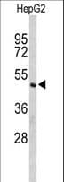 Polyclonal Rabbit anti-Human CFLAR / FLIP Antibody (aa145-174, IHC, WB)