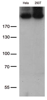 Monoclonal Mouse anti-Human CAD Antibody (clone OTI1A7, aa1918-2225, WB)