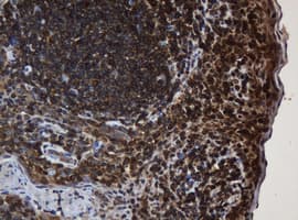 PAI-RBP1 / SERBP1 Antibody (aa1-262, clone OTI2C11)
