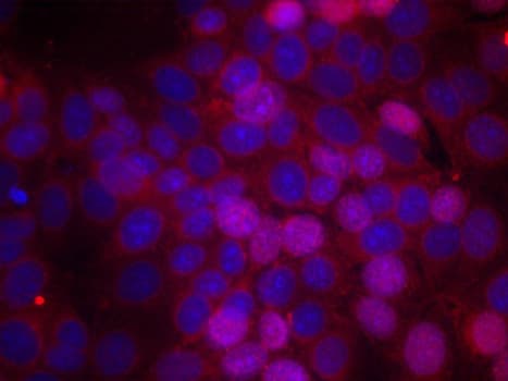 Polyclonal Rabbit anti-Human ER Alpha / Estrogen Receptor Antibody (phospho-Ser106, IHC, IF, WB)