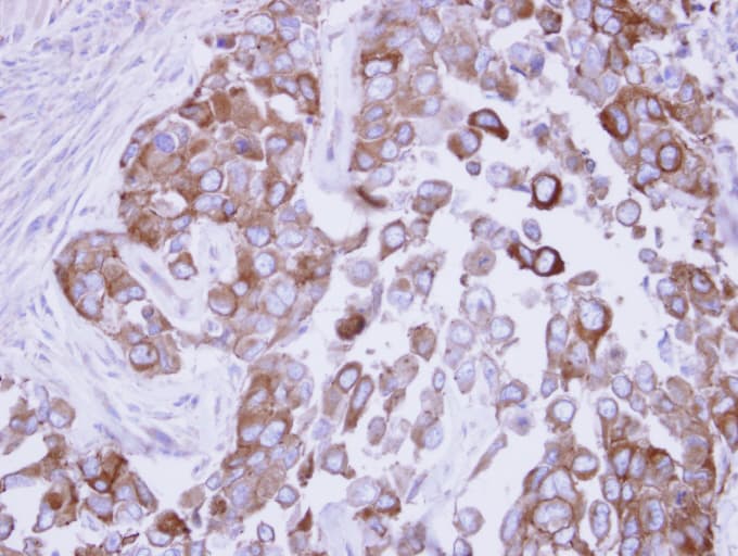 FASN / Fatty Acid Synthase Antibody (aa401-694)