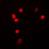 ZC3HC1 / NIPA Antibody (Internal)