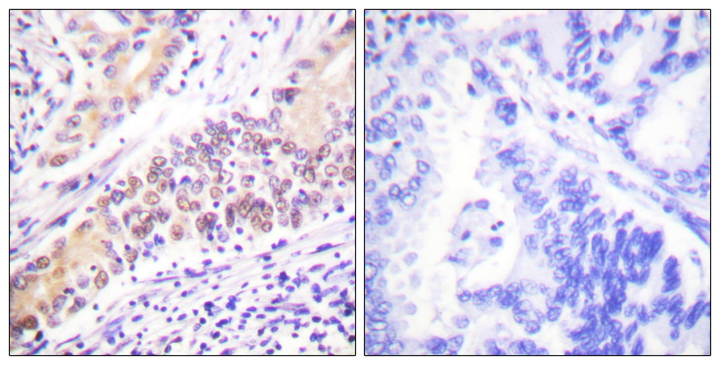 Polyclonal Rabbit anti-Human TOP2B / Topoisomerase II Beta Antibody (aa1-50, IHC, WB)