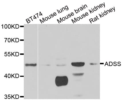 IHC-plus™ ADSS Antibody
