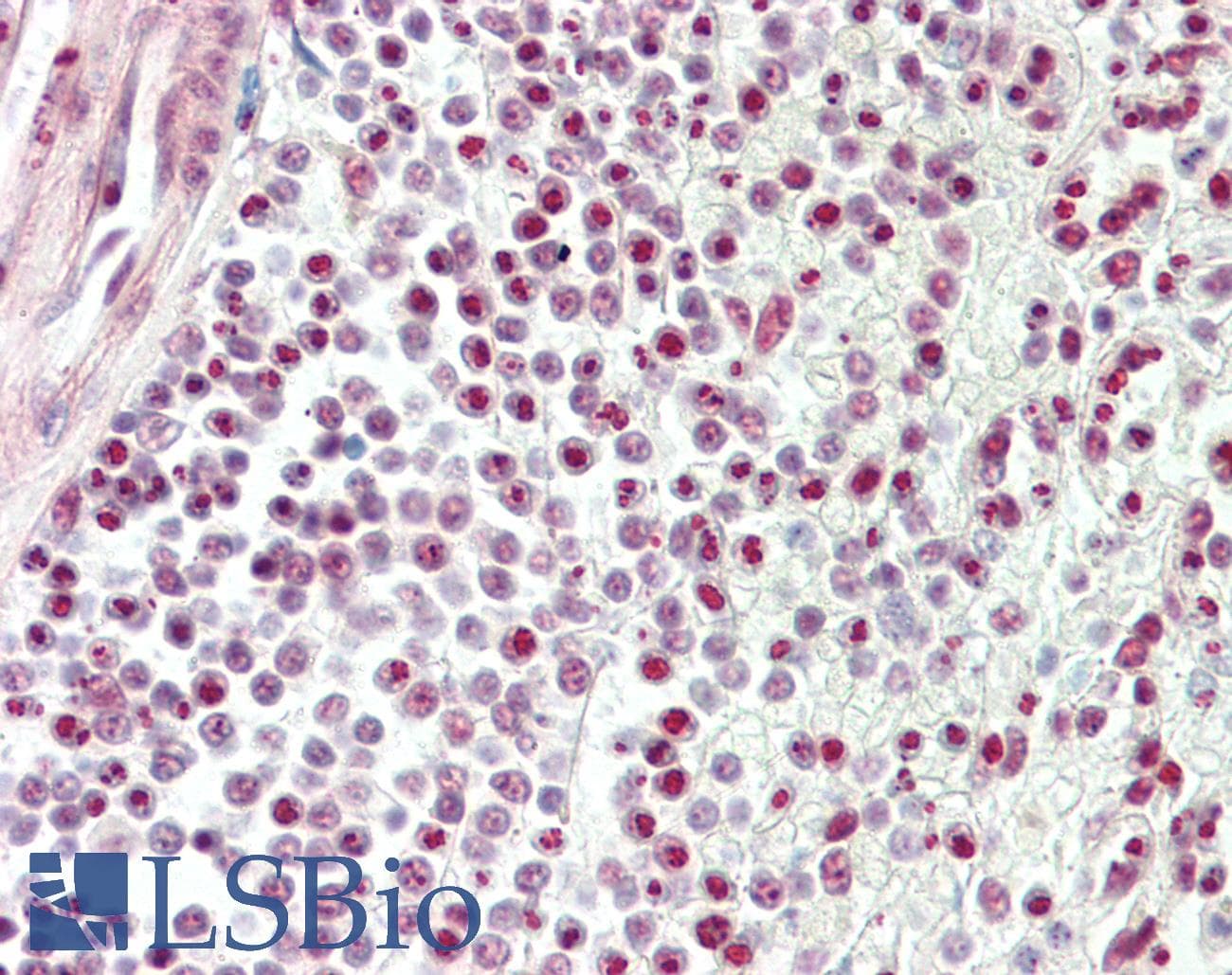 PathPlus™ TDP-43 / TARDBP Antibody (aa1-30)