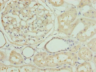 Polyclonal Rabbit anti-Human ZNF274 Antibody (IHC)