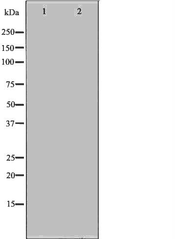 Polyclonal Rabbit anti-Human RACGAP1 / MGCRACGAP Antibody (IHC, IF, WB)