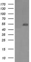 MDM4 / MDMX Antibody (clone OTI1D11)