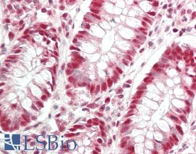 IHC-plus™ Polyclonal Rabbit anti-Human EFTUD2 Antibody (aa1-50, IHC, WB)