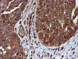 PSMB9 Antibody (clone OTI2B6)
