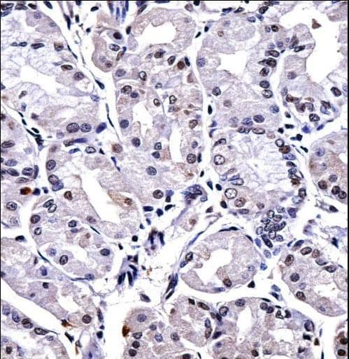 FOXP4 Antibody (aa522-550)