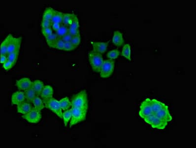CPB2 / TAFI Antibody
