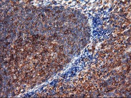 ENPEP / Aminopeptidase A Antibody (clone OTI3G1)