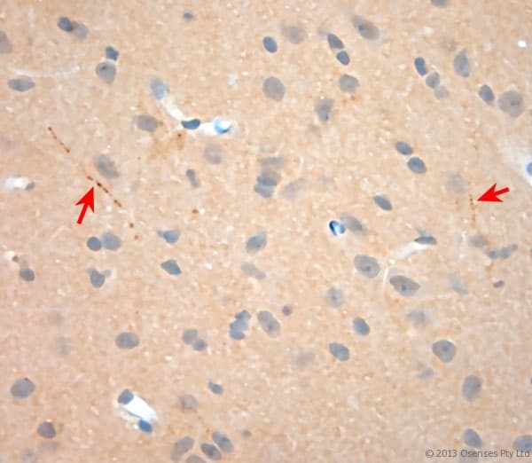 NGF Antibody (aa130-180)