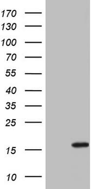 IL1RN Antibody (clone OTI2B1)