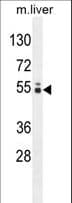 Polyclonal Rabbit anti-Human GLCCI1 Antibody (aa104-133, WB)