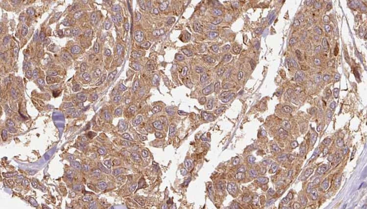Polyclonal Rabbit anti-Human CYTL1 / C17 Antibody (IHC, IF, WB)
