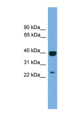 SOCS1 Antibody (aa107-156)