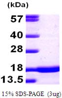 Mouse SNCA / Alpha-Synuclein Protein (Recombinant)