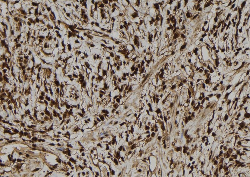 Polyclonal Rabbit anti-Human DSC92 / NGRN Antibody (IHC, WB)