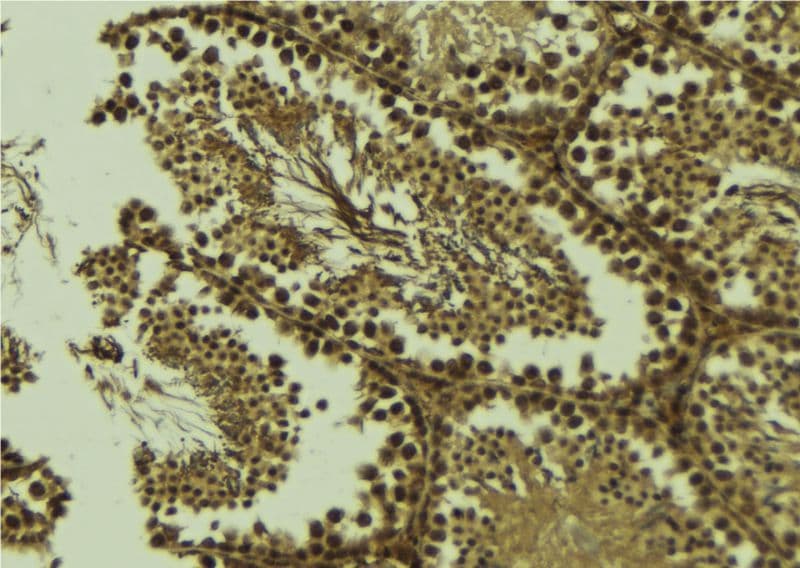 Polyclonal Rabbit anti-Human PCA1 / ALKBH3 Antibody (IHC, WB)