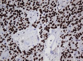 ZSCAN18 / ZNF447 Antibody (clone OTI2A9)