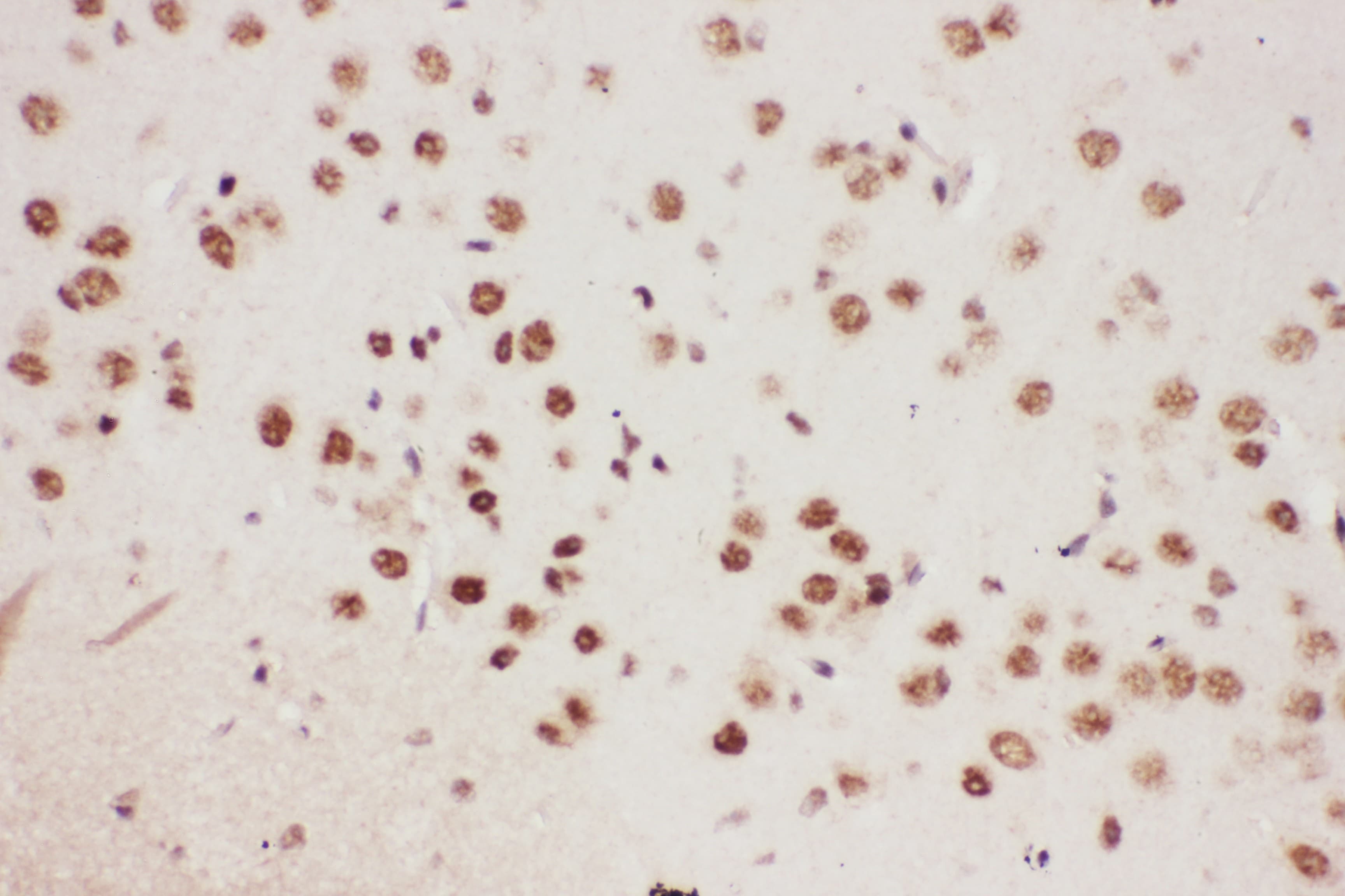 ALOX5 / 5-LOX Antibody (aa120-483)