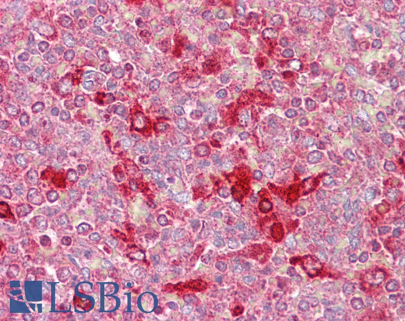 CELF2 / CUGBP2 Antibody (N-Terminus)