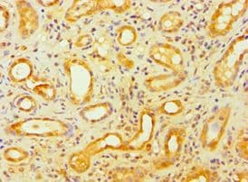 DFNA5 Antibody (aa1-260)